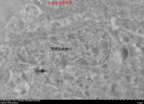 免疫電鏡標記